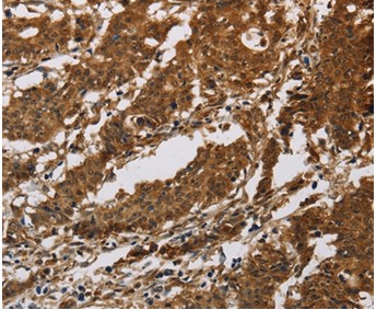 Immunohistochemistry (Formalin/PFA-fixed paraffin-embedded sections) - Anti-IL-17RB antibody (AB198891)