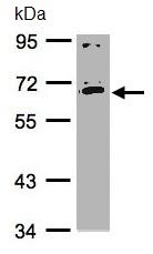 Western blot - Anti-IL-17RC antibody (AB96310), expandable thumbnail