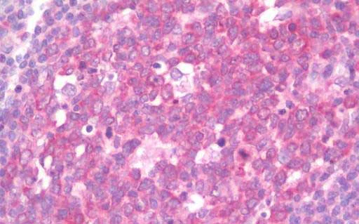 Immunohistochemistry (Formalin/PFA-fixed paraffin-embedded sections) - Anti-IL-17RE antibody (AB219755)