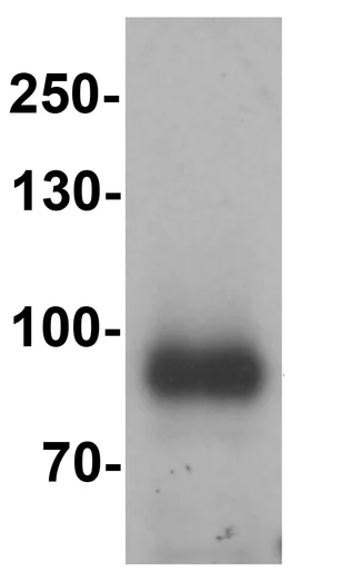 Western blot - Anti-IL-17RE antibody (AB219755)