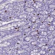Immunohistochemistry (Formalin/PFA-fixed paraffin-embedded sections) - Anti-IL-17REL antibody (AB126399), expandable thumbnail