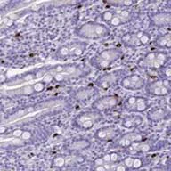 Immunohistochemistry (Formalin/PFA-fixed paraffin-embedded sections) - Anti-IL-17REL antibody (AB126399)