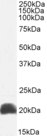Western blot - Anti-IL-18 antibody [125-2H] (AB245697)