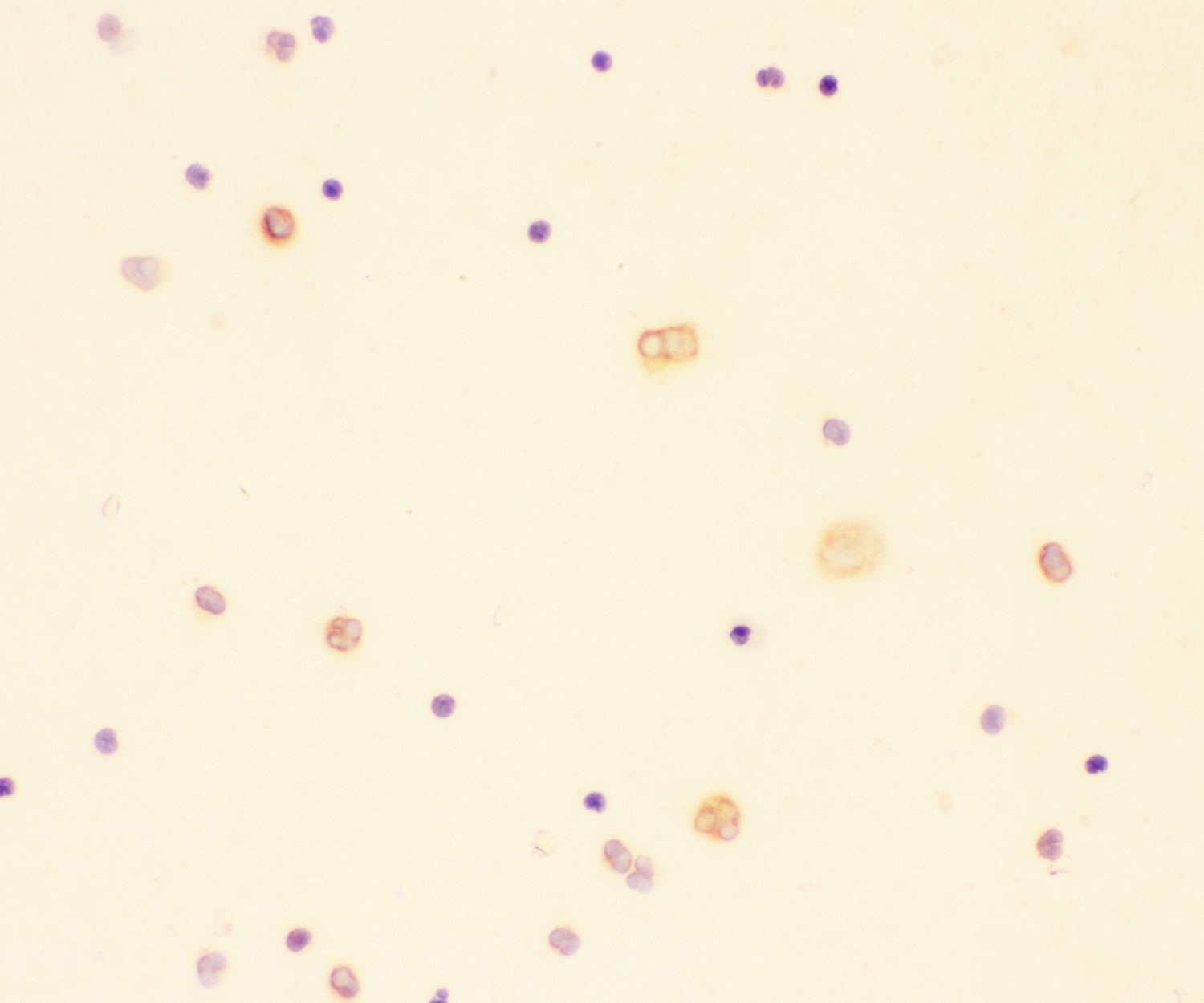 Immunocytochemistry - Anti-IL-18 antibody (AB191152)