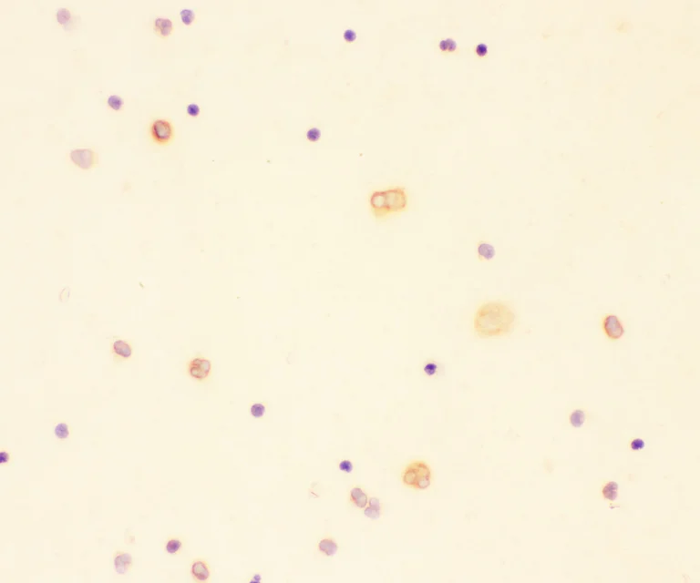 Immunocytochemistry - Anti-IL-18 antibody (AB191152)