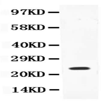 Western blot - Anti-IL-18 antibody (AB191152)