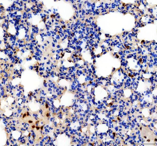 Immunohistochemistry (Formalin/PFA-fixed paraffin-embedded sections) - Anti-IL-18 antibody (AB191860)
