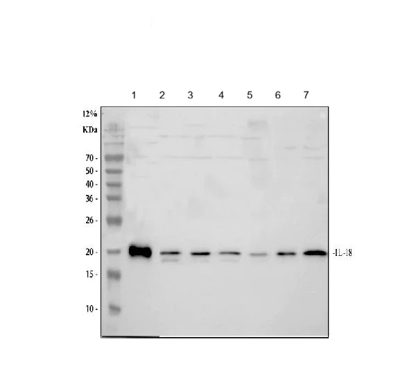 Western blot - Anti-IL-18 antibody (AB191860)