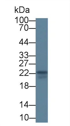 Western blot - Anti-IL-18 antibody [C8] (AB239611)