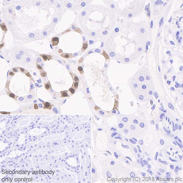 Immunohistochemistry (Formalin/PFA-fixed paraffin-embedded sections) - Anti-IL-18 antibody [EPR19954-188] (AB243091), expandable thumbnail