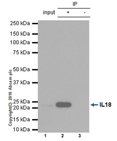 Immunoprecipitation - Anti-IL-18 antibody [EPR19956] (AB207323), expandable thumbnail