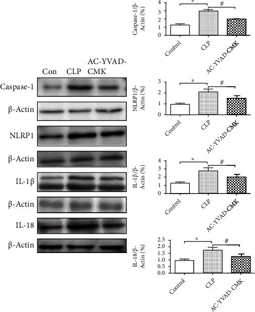 Western blot - Anti-IL-18 antibody [EPR19956] (AB207323), expandable thumbnail