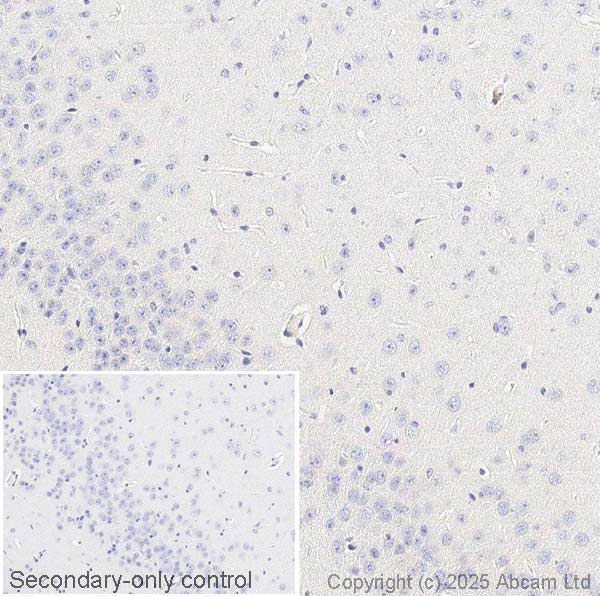 Immunohistochemistry (Formalin/PFA-fixed paraffin-embedded sections) - Anti-IL-18 antibody [EPR22249-212] (AB223293)