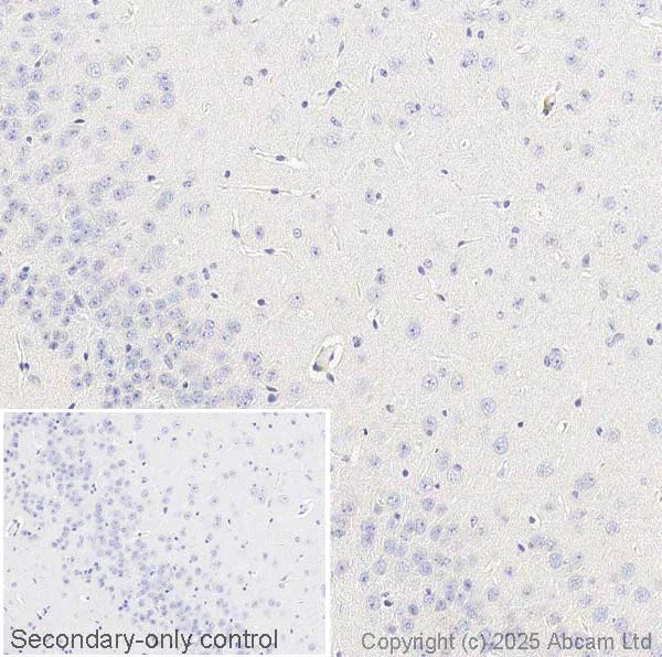 Immunohistochemistry (Formalin/PFA-fixed paraffin-embedded sections) - Anti-IL-18 antibody [EPR22249-212] (AB223293)