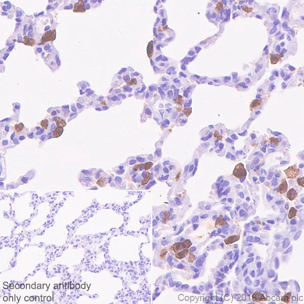 Immunohistochemistry (Formalin/PFA-fixed paraffin-embedded sections) - Anti-IL-18 antibody [EPR22249-212] - BSA and Azide free (AB242022)