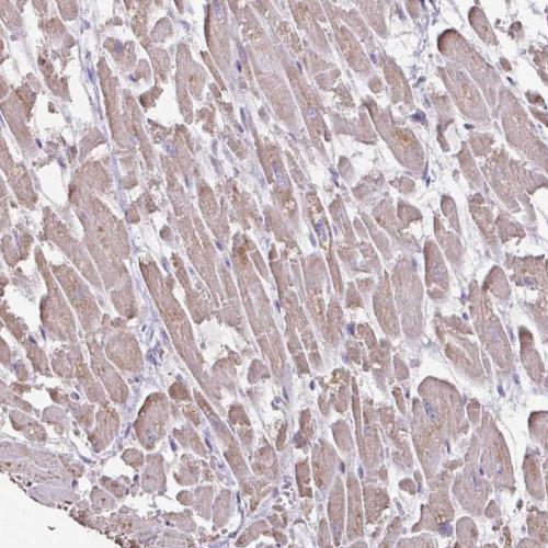 Immunohistochemistry (Formalin/PFA-fixed paraffin-embedded sections) - Anti-IL-18BP antibody (AB204487)