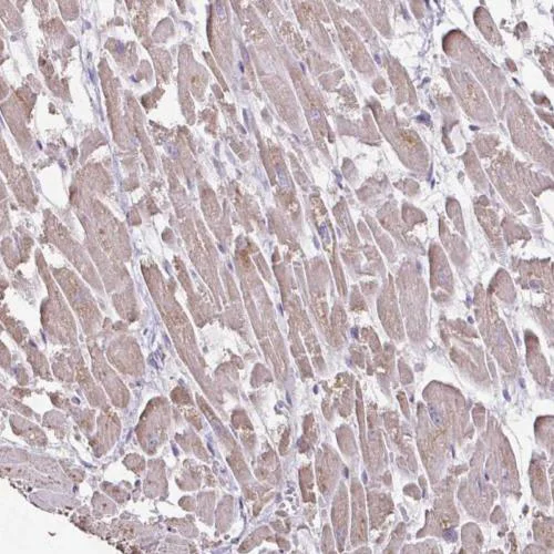 Immunohistochemistry (Formalin/PFA-fixed paraffin-embedded sections) - Anti-IL-18BP antibody (AB204487)
