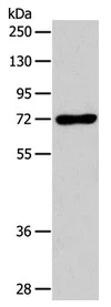 Western blot - Anti-IL-18R Beta/IL-18RAP antibody (AB197832)