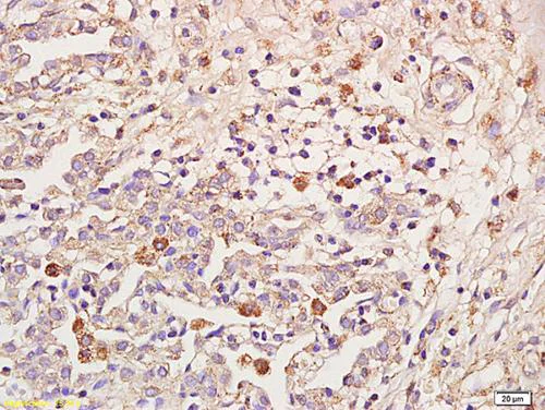 Immunohistochemistry (Formalin/PFA-fixed paraffin-embedded sections) - Anti-IL-18R Beta/IL-18RAP antibody (AB203191)