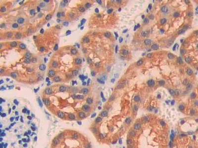 Immunohistochemistry (Formalin/PFA-fixed paraffin-embedded sections) - Anti-IL-18R1 antibody (AB231554)