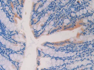 Immunohistochemistry (Formalin/PFA-fixed paraffin-embedded sections) - Anti-IL-18R1 antibody (AB231565)