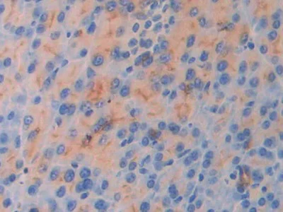 Immunohistochemistry (Formalin/PFA-fixed paraffin-embedded sections) - Anti-IL-18R1 antibody (AB231565)