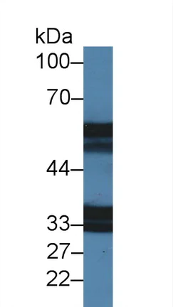 Western blot - Anti-IL-18R1 antibody (AB231565)