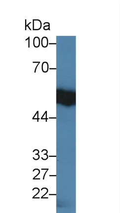 Western blot - Anti-IL-18R1 antibody (AB231565)