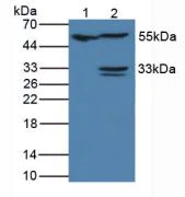 Western blot - Anti-IL-18R1 antibody (AB231565)