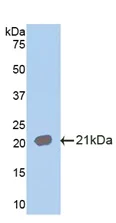 Western blot - Anti-IL-18R1 antibody (AB231565)