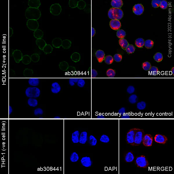 Immunocytochemistry/ Immunofluorescence - Anti-IL-18R1 antibody [EPR26127-35] (AB308441)