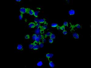 Immunocytochemistry/ Immunofluorescence - Anti-IL-19 antibody [EPNCIR168] (AB154187)