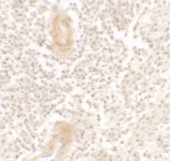 Immunohistochemistry (Formalin/PFA-fixed paraffin-embedded sections) - Anti-IL-1F10 antibody - C-terminal (AB180898)
