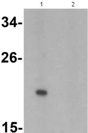 Western blot - Anti-IL-1F10 antibody - C-terminal (AB180898)