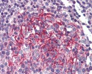 Immunohistochemistry (Formalin/PFA-fixed paraffin-embedded sections) - Anti-IL-1R-2 antibody (AB189648)