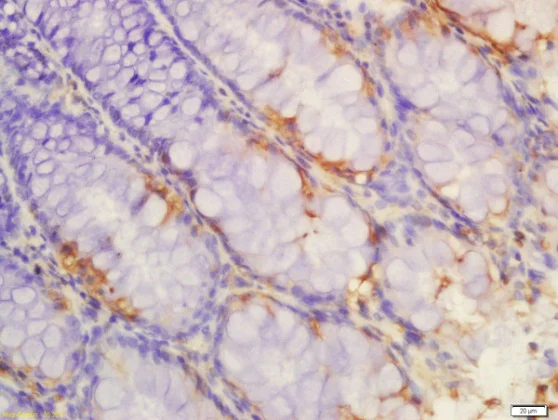 Immunohistochemistry (Formalin/PFA-fixed paraffin-embedded sections) - Anti-IL-1R-2 antibody (AB212208)