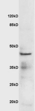 Western blot - Anti-IL-1R-2 antibody (AB212208)