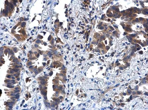 Immunohistochemistry (Formalin/PFA-fixed paraffin-embedded sections) - Anti-IL-1R-2 antibody (AB97388)