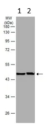 Western blot - Anti-IL-1R-2 antibody (AB97388)