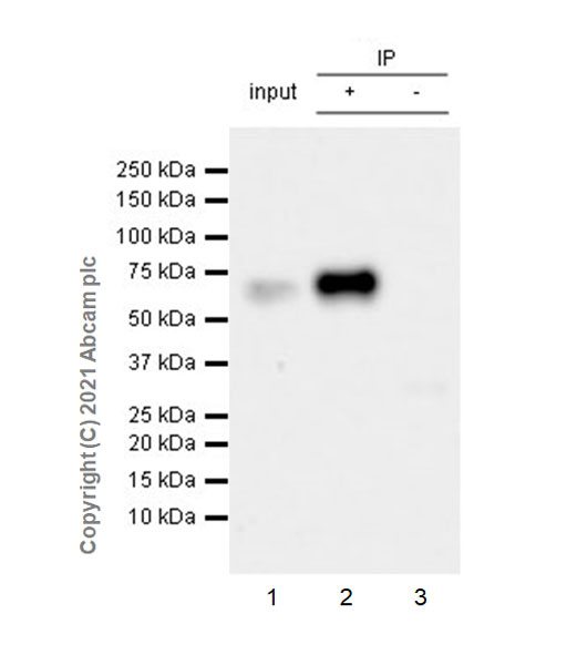 Immunoprecipitation - Anti-IL-1R-2 antibody [EPR24695-36] (AB273025), expandable thumbnail