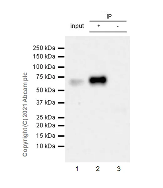 Immunoprecipitation - Anti-IL-1R-2 antibody [EPR24695-36] (AB273025)
