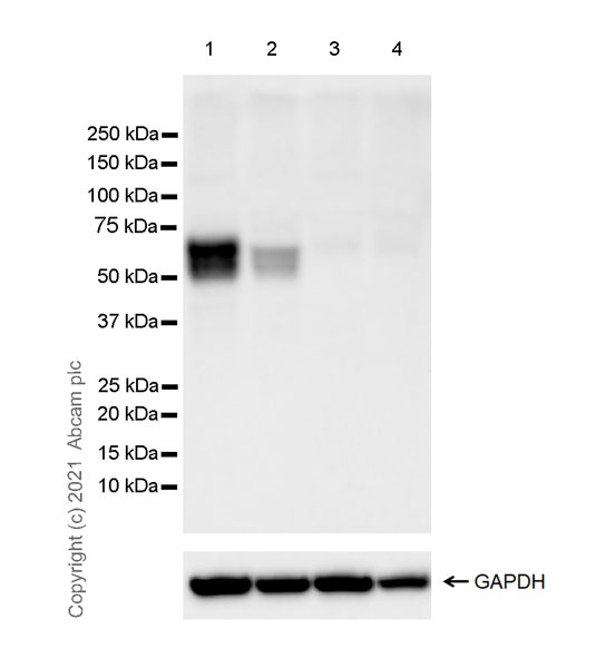 Western blot - Anti-IL-1R-2 antibody [EPR24695-36] (AB273025), expandable thumbnail
