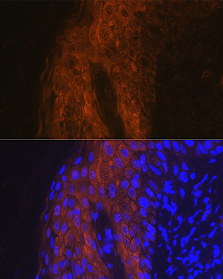 Immunocytochemistry/ Immunofluorescence - Anti-IL-1RA antibody (AB175392)