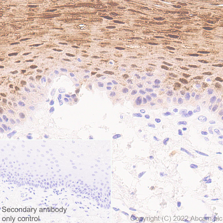 Immunohistochemistry (Formalin/PFA-fixed paraffin-embedded sections) - Anti-IL-1RA antibody [EPR26853-58] (AB303490)