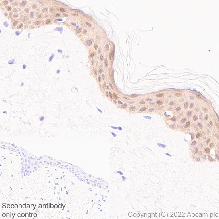 Immunohistochemistry (Formalin/PFA-fixed paraffin-embedded sections) - Anti-IL-1RA antibody [EPR26853-58] (AB303490)