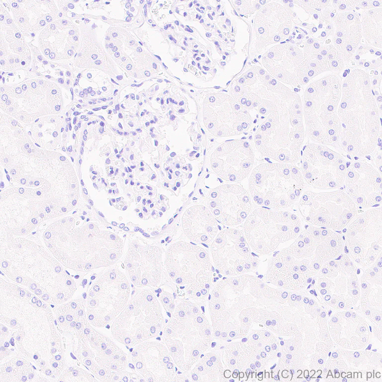 Immunohistochemistry (Formalin/PFA-fixed paraffin-embedded sections) - Anti-IL-1RA antibody [EPR26853-58] (AB303490)