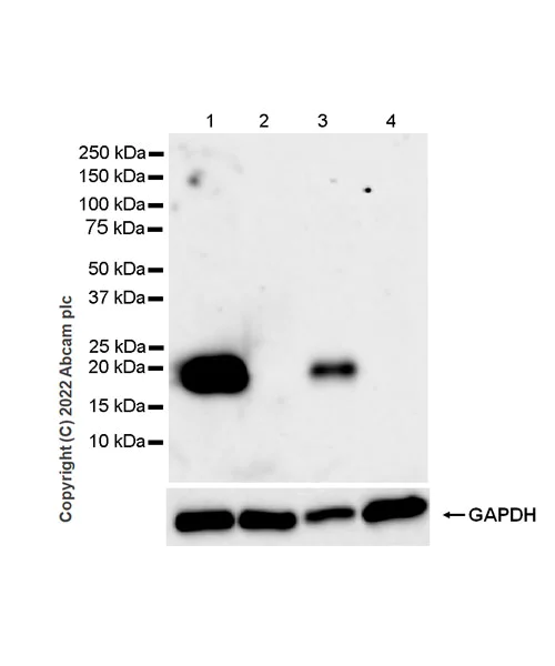 Western blot - Anti-IL-1RA antibody [EPR26853-58] (AB303490)