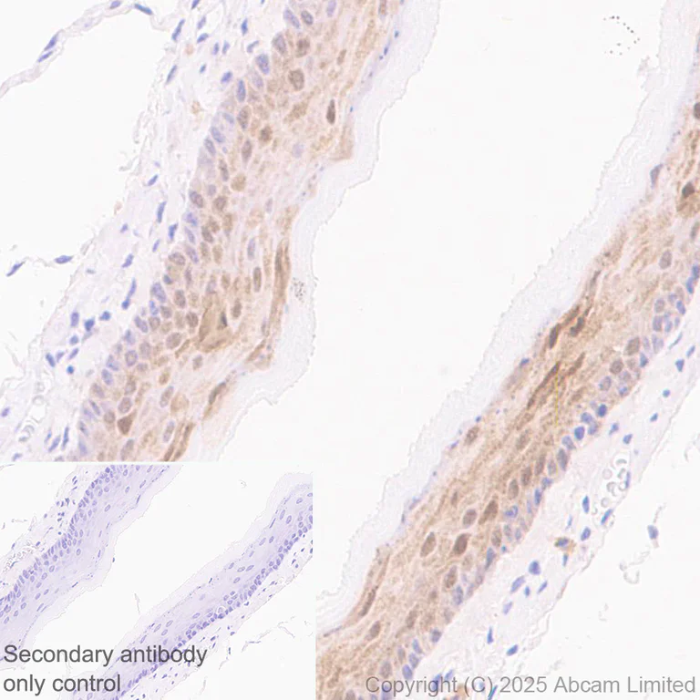 Immunohistochemistry (Formalin/PFA-fixed paraffin-embedded sections) - Anti-IL-1RA antibody [EPR29922-572] (AB324456)