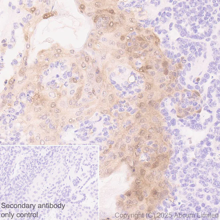Immunohistochemistry (Formalin/PFA-fixed paraffin-embedded sections) - Anti-IL-1RA antibody [EPR29922-572] (AB324456)