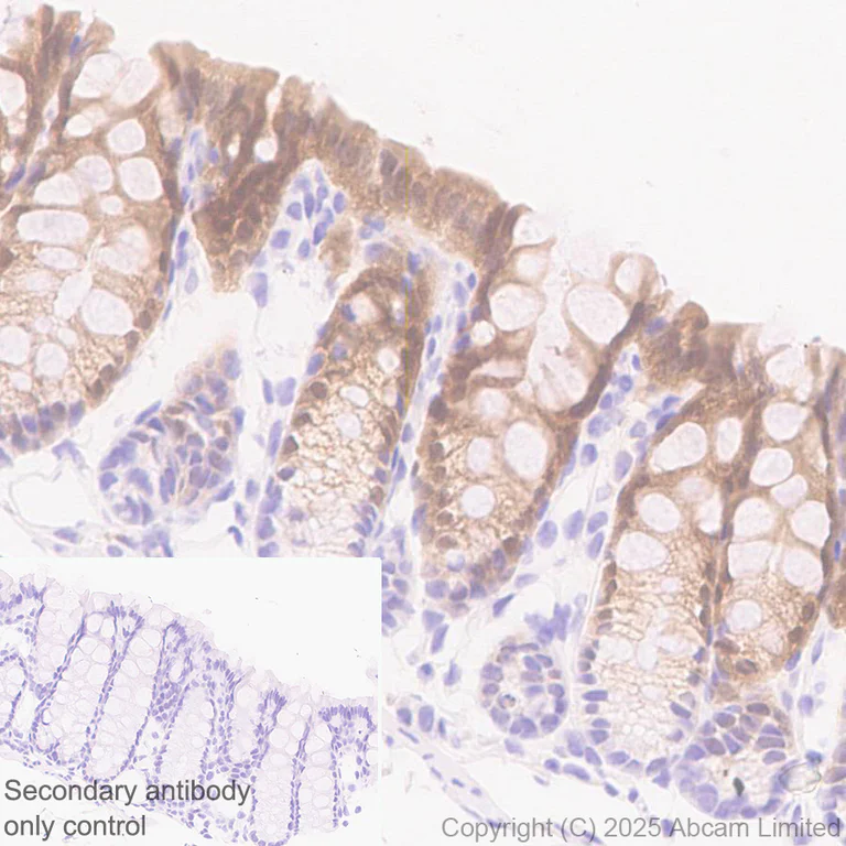 Immunohistochemistry (Formalin/PFA-fixed paraffin-embedded sections) - Anti-IL-1RA antibody [EPR29922-572] (AB324456)